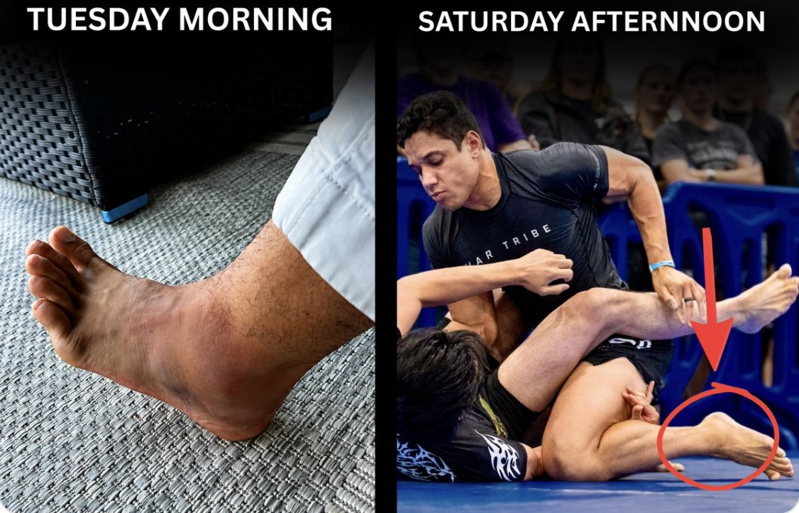 Gabe Pluguez ankle sprain Tuesday, BJJ gold Saturday